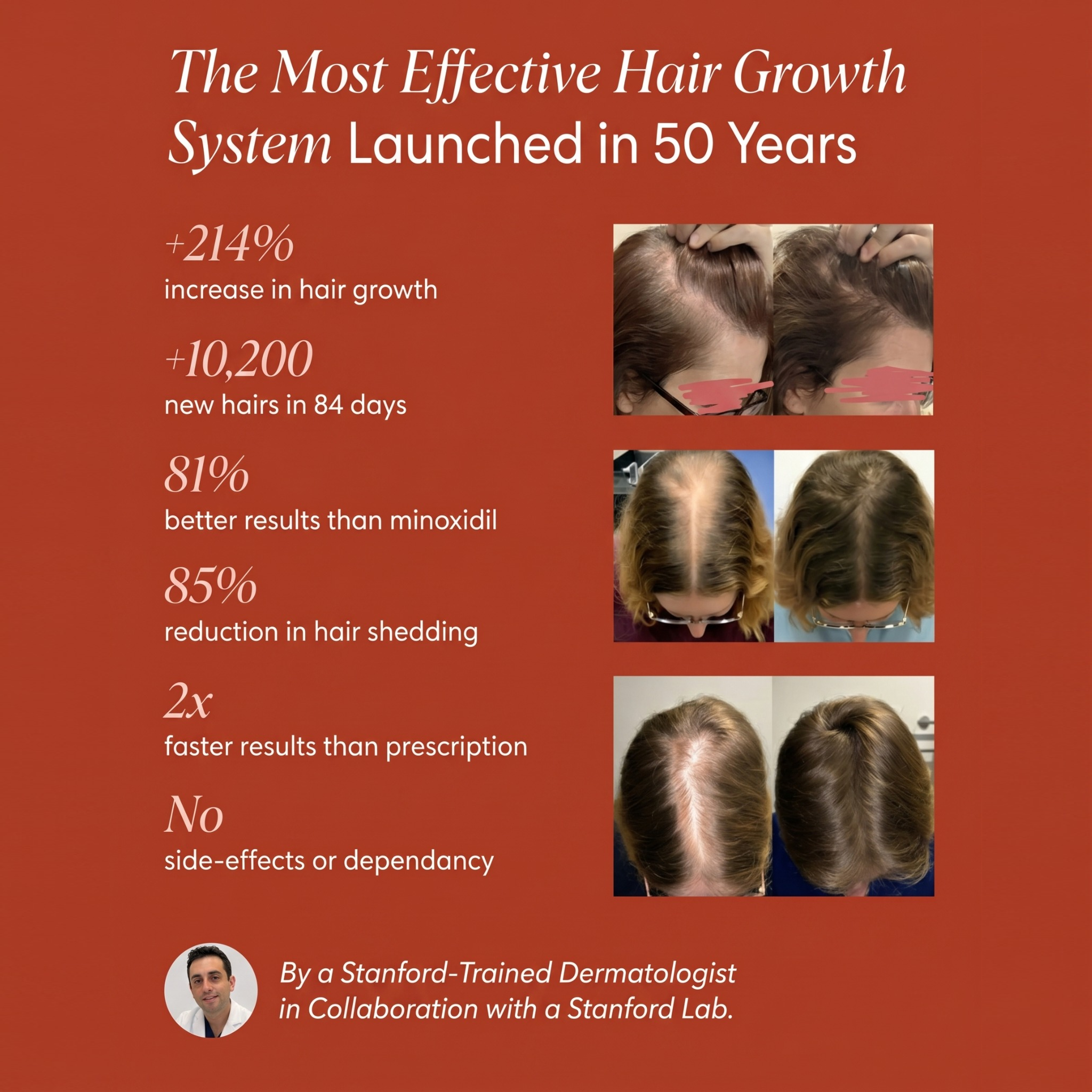 Fevura Onion & Rosemary – Hair Growth Set to Restore Strength and Shine